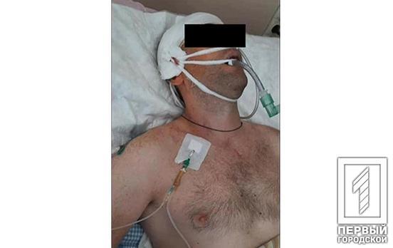 У Кривому Розі шукають очевидців аварії, де серйозно постраждав мотоцикліст