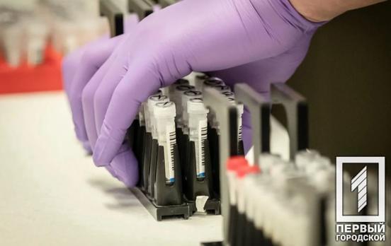 В Днепре у женщины экспресс-тест показал позитивный результат на коронавирус, проводят дополнительную диагностику, – облздрав