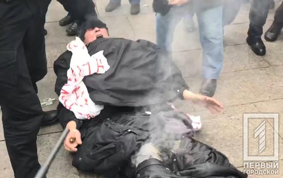 Под Офисом Президента мужчина поджёг себя, его госпитализировали