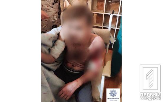 В Кривом Роге пьяного мужчину покусал собственный пёс