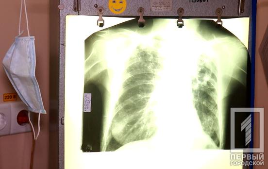 В Кривом Роге за сутки выявили 60 новых случаев заражения COVID-19, 10 пациентов умерли