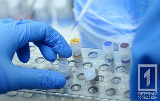 В Днепропетровской области пациентам с пневмонией будут делать обязательные тесты на COVID-19