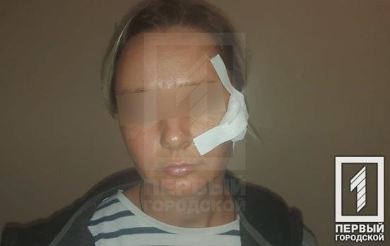 Бросили бутылку из окна машины: в Кривом Роге девушке разбили голову