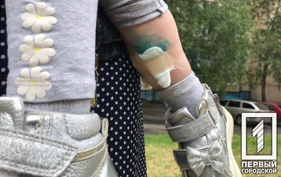 В Кривом Роге собака покусала трёхлетнюю девочку