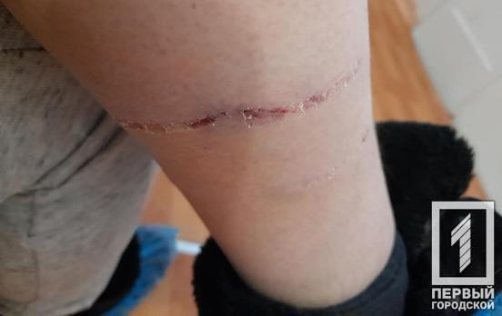 Жительницу Кривого Рога покусала собака, – соцсети