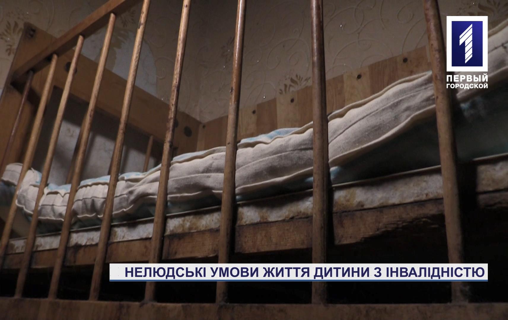 Новини Кривого Рогу: через недбалий догляд підліток із інвалідністю важить меньше дев'яти кілограмів