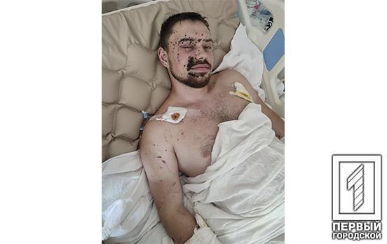 Хлопець із Кривого Рогу потребує допомоги: під час завдання в зоні ООС важко поранили нашого земляка