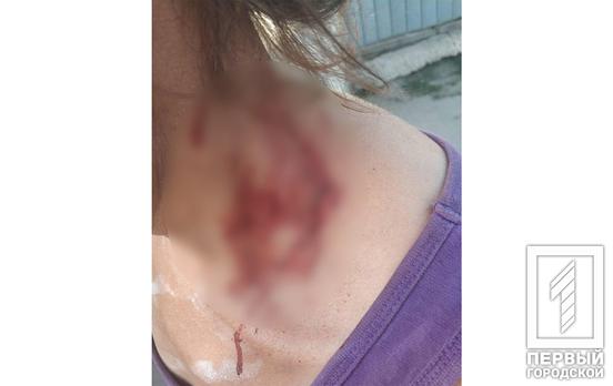 В Кривом Роге задержали мужчину, который порезал свою сестру стеклом