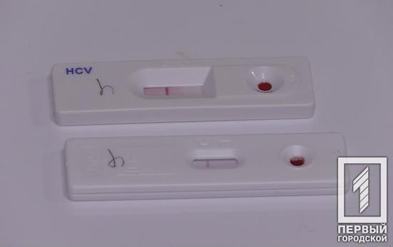 У Дніпропетровській області в 2021 році ВІЛ-інфекцію виявили у 2 960 осіб, - статистика