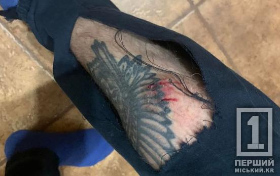 Двоє собак покусали чоловіка у Центрально-Міському районі Кривого Рогу