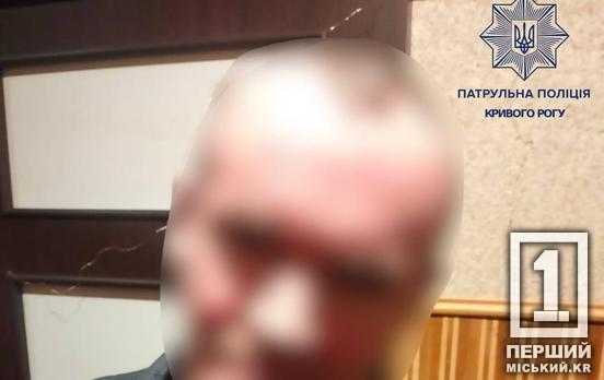 Градус в крови вызвал острое желание пообщаться с кем-то в форме: криворожец сам на себя заявил в полицию