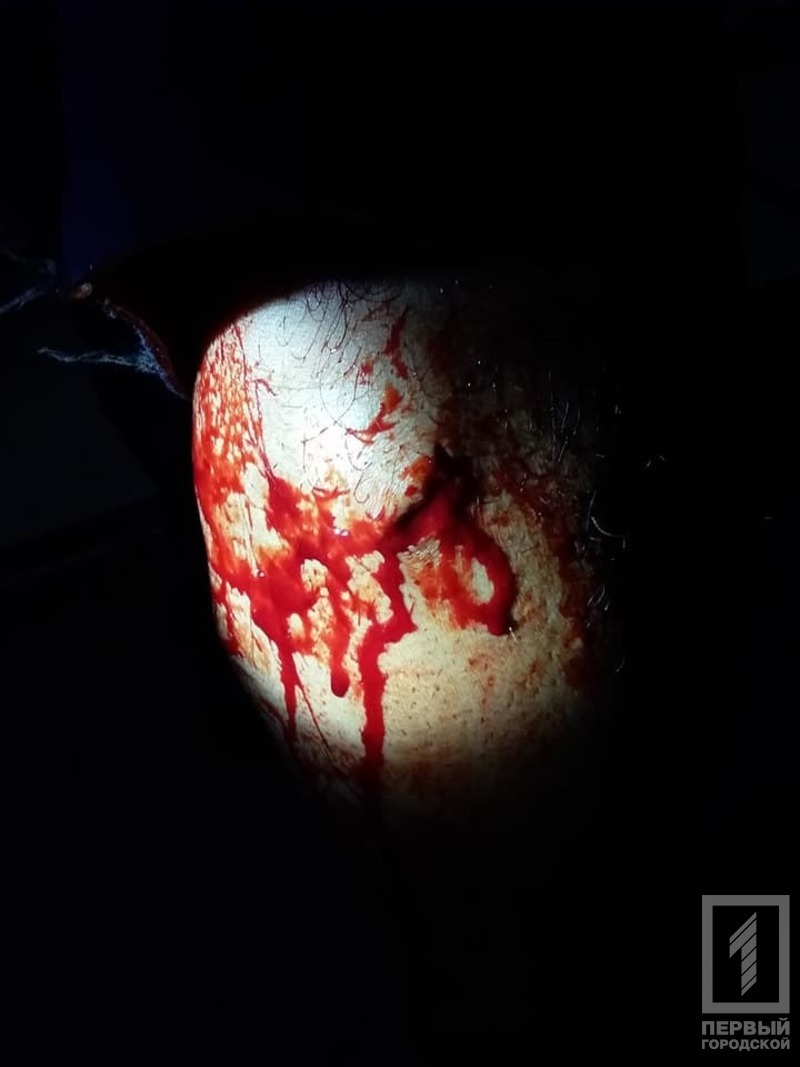 %d0%bd%d0%be%d0%b3%d0%b0